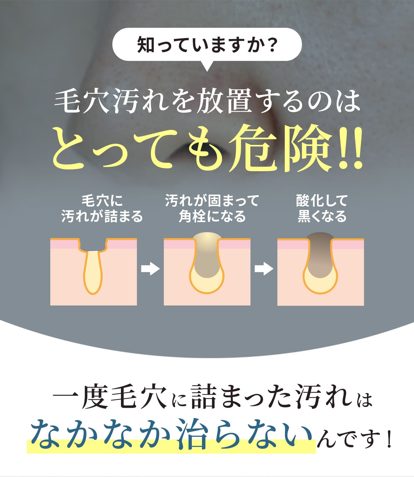 知っていますか？毛穴汚れを放置するのはとっても危険！！